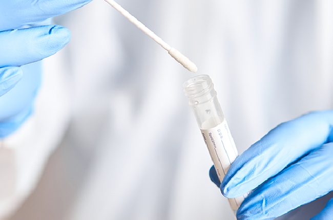 L’épidémie Covid repart en France et notamment dans les Ardennes avec un taux de 122 cas pour 100 000 habitants 
